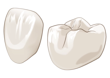 歯の被せ物材質イラスト