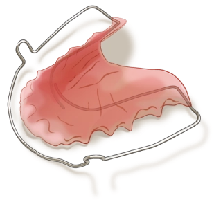 矯正器具のイラスト