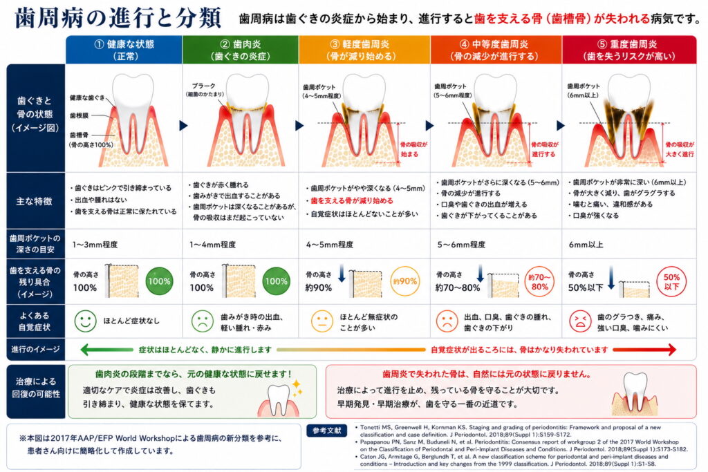 歯周病の進行と分類